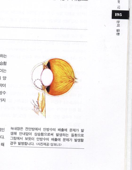 [re] 녹내장은....