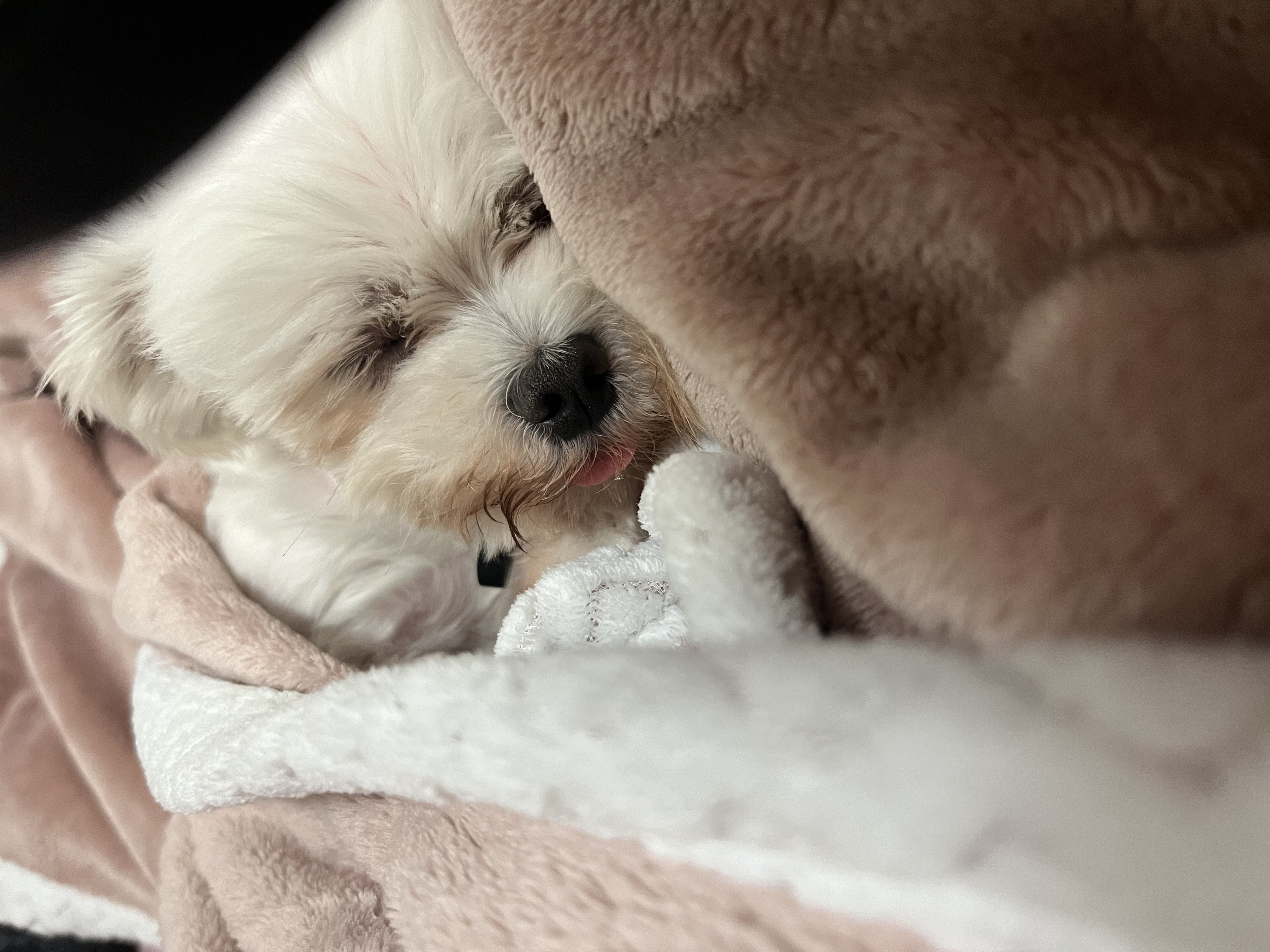 예티임보 1개월차 후기