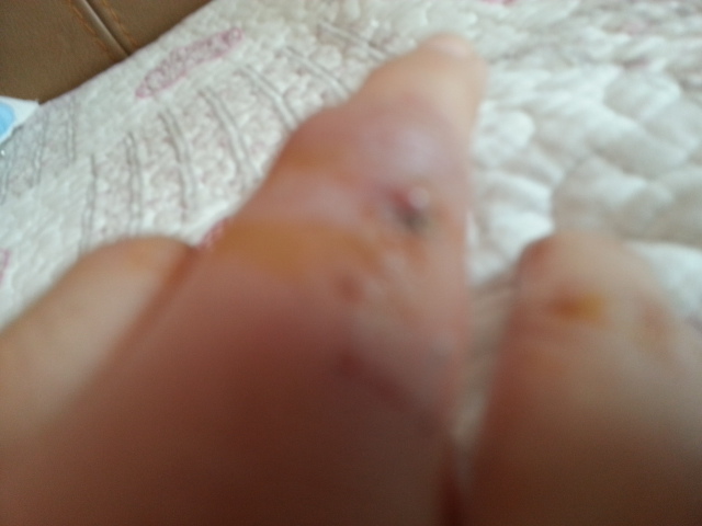 흰둥이 (사랑이) 벌써 한달이 지났네요 2차후기 망서려지더라구요